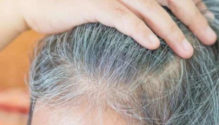 इन टिप्स को अपना कर बालों का सफेद होने से बचाए… इन टिप्स को अपना कर बालों का सफेद होने से बचाए…