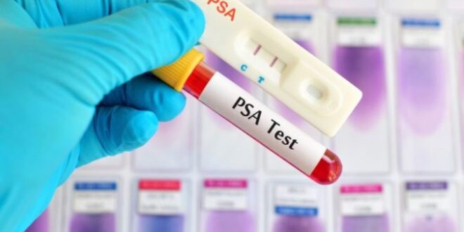 आज के लेख में PSA Test के फायदों के बारे में साथ ही साथ इसे करवाते समय किन- किन बातों का ध्यान रखना जरूरी है..